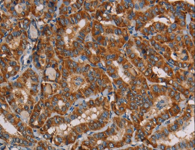 MRPL39 Antibody