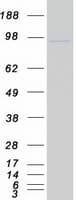 Human CDC5 / CDC5L Protein (Recombinant Myc-DDK (Flag))
