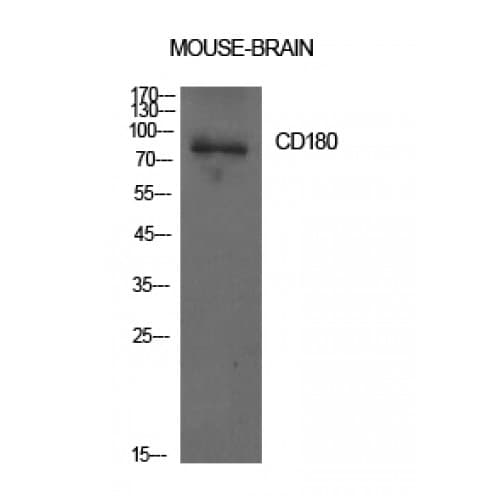 RP105 / CD180 Antibody (221-270 aa, Internal)