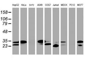 PPT1 / CLN1 Antibody (aa100-306, clone OTI1B10)