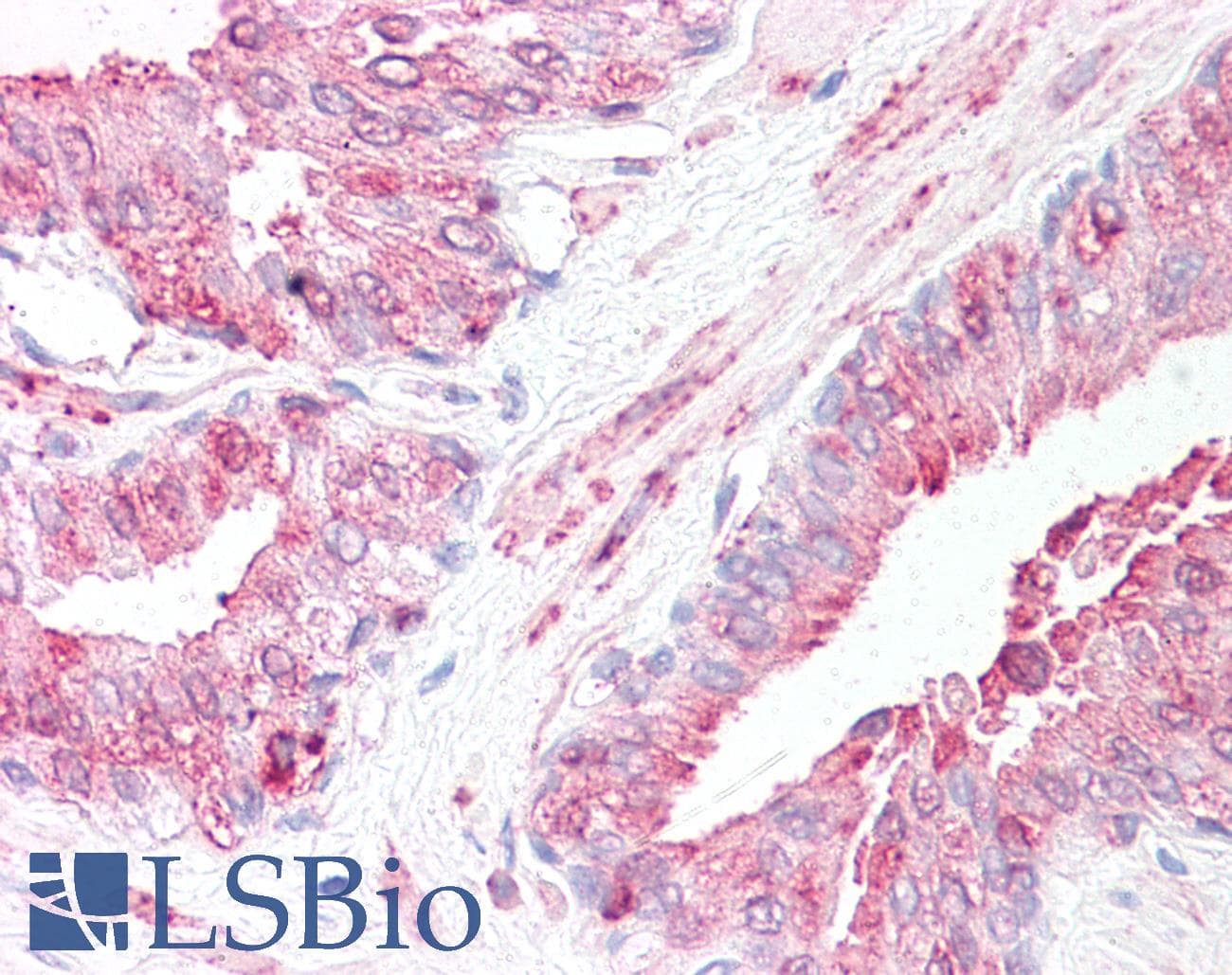 IHC-plus™ SLITRK6 Antibody (N-Terminus)