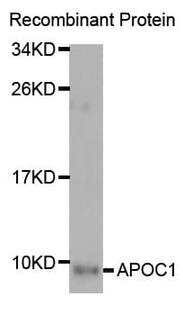 Polyclonal Rabbit anti-Human Apolipoprotein C-I Antibody (IHC, WB)