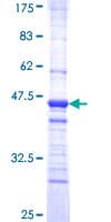 Human PDEF / SPDEF Protein (Recombinant GST, N-terminus)