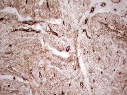 Adiponectin Antibody (aa19-244, clone OTI3G10)