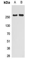 NCOR2 / SMRT Antibody (Internal)