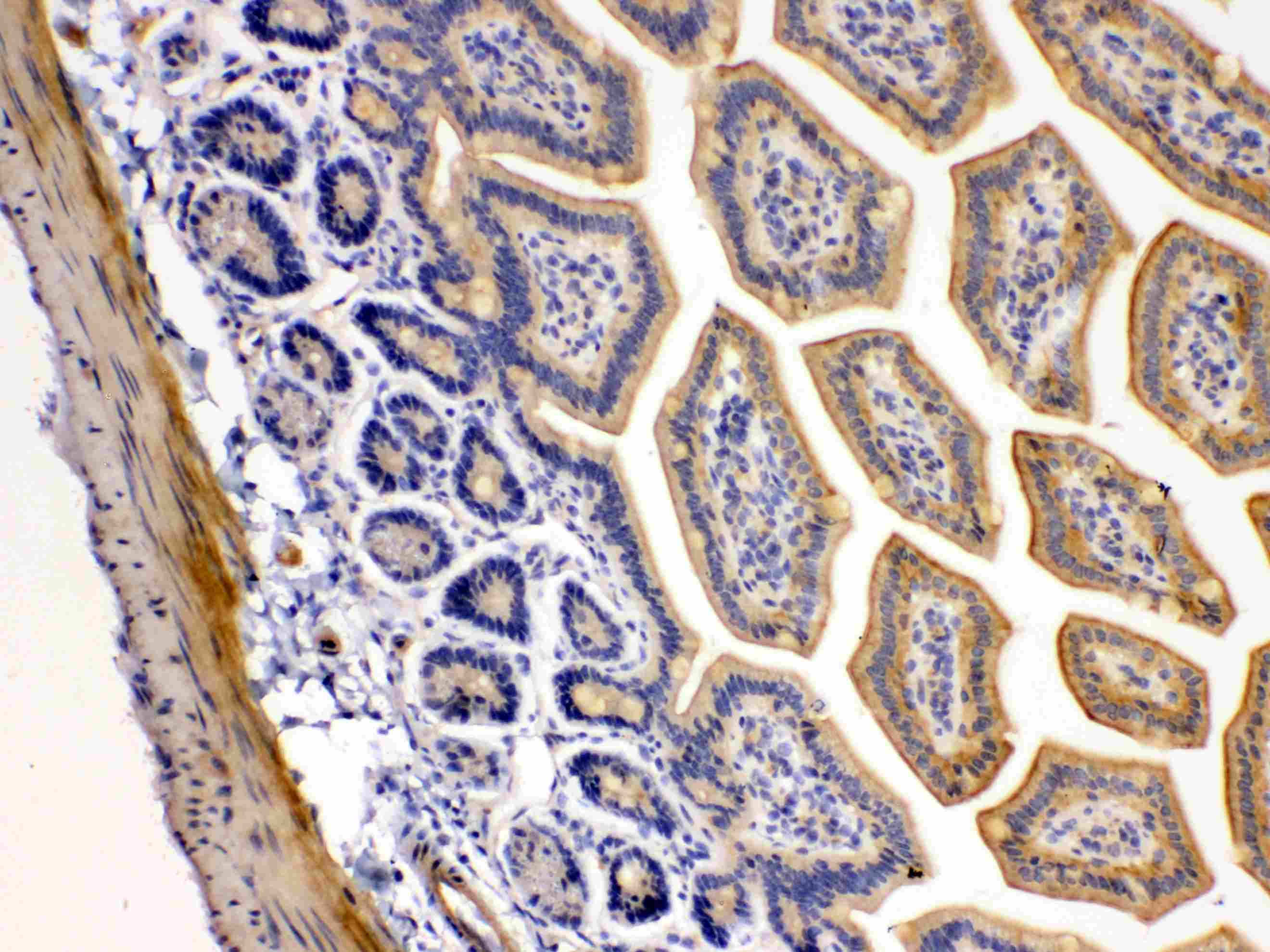 TNFRSF10B / Killer / DR5 Antibody