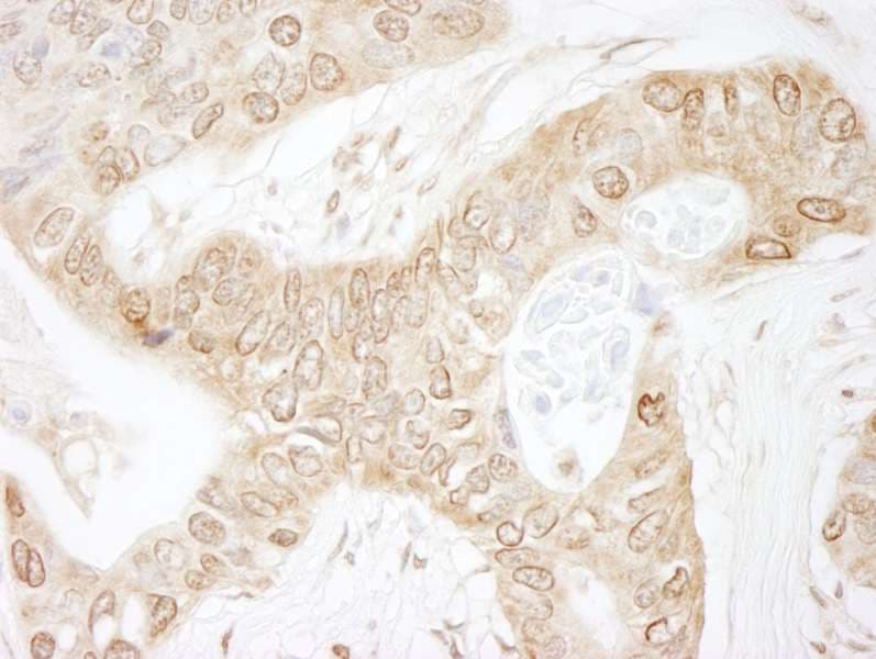 CHUK / IKKA / IKK Alpha Antibody (aa350-400)