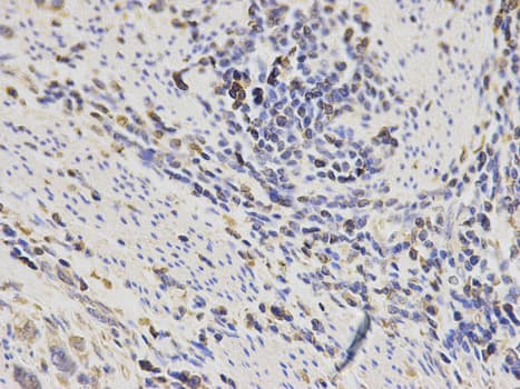 IHC-plus™ SH2D1A / SAP Antibody