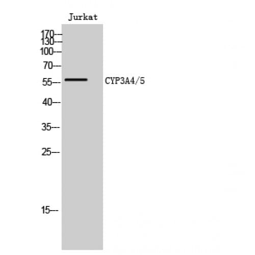 Polyclonal Rabbit anti-Human CYP3A4+5 Antibody (220-300 aa, Internal, IHC, IF, WB)