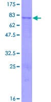 Human FDXR Protein (Recombinant GST)