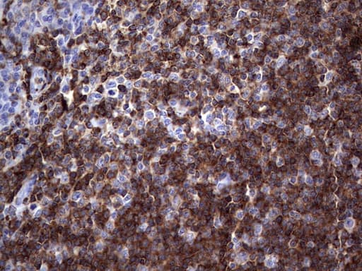 Monoclonal Mouse anti-Human TFPI2 Antibody (clone OTI1D4, aa23-235, IHC, WB)