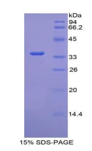 Human F5 / Factor Va Protein (Recombinant His)