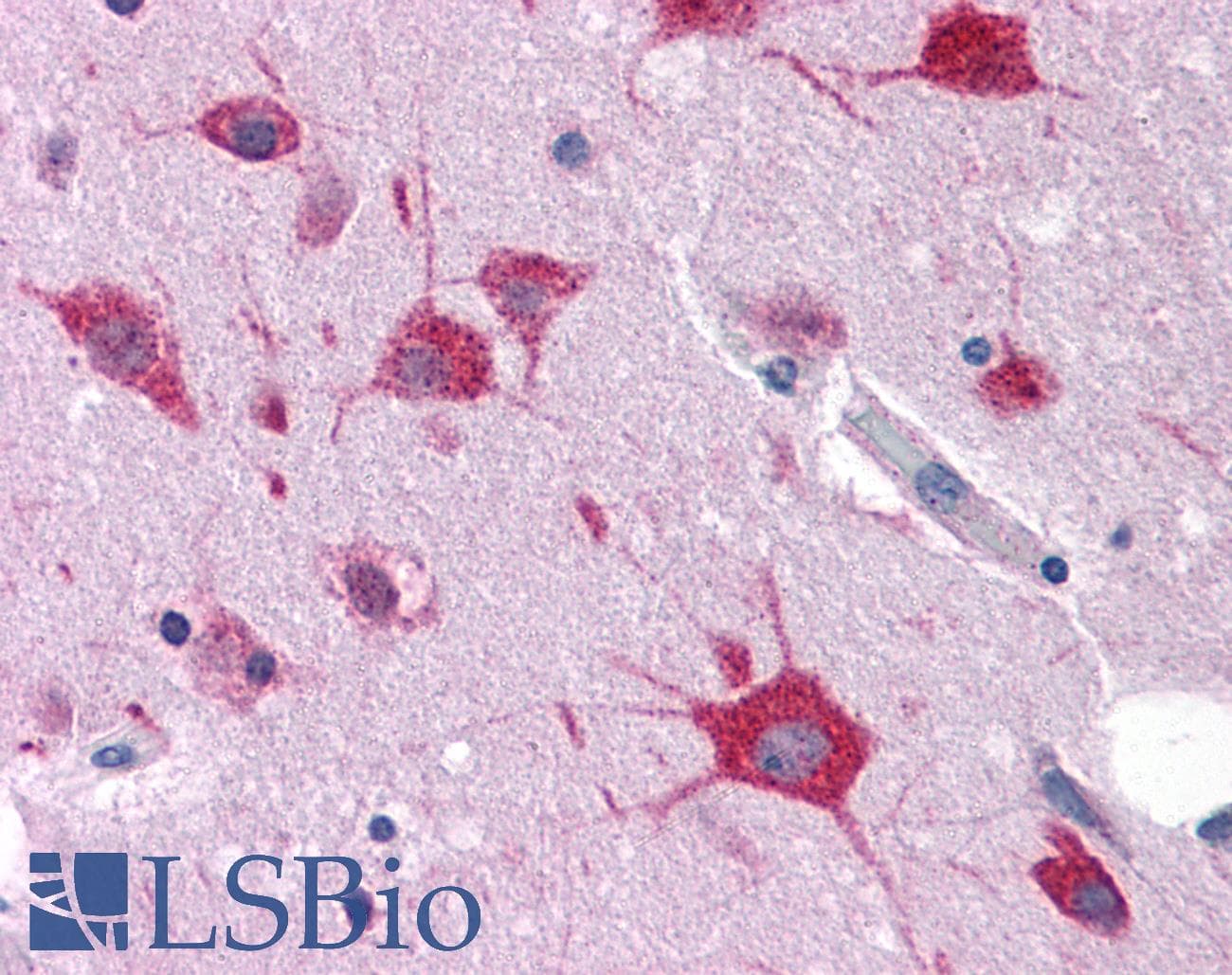 IHC-plus™ GAREM / FAM59A Antibody