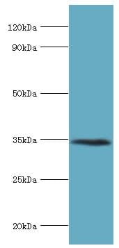 Polyclonal Rabbit anti-Human LYVE1 Antibody (aa20-238, IHC, WB)