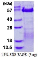 Human VRK3 Protein (Recombinant His)