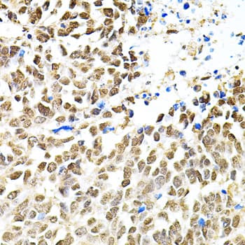 PNKP Antibody