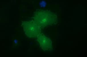 EPCAM Antibody (clone OTI1C1)