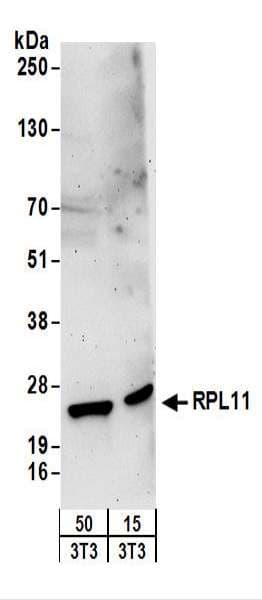 RPL11 / Ribosomal Protein L11 Antibody (aa128-178)