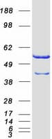 Human CAP1 Protein (Recombinant Myc-DDK (Flag))
