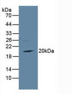 TIRAP Antibody (aa1-221, APC)