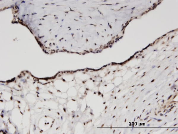 RPS11 / Ribosomal Protein 11 Antibody (clone 2A5)