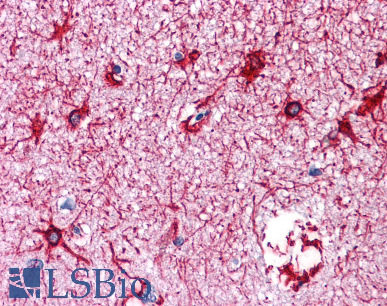 IHC-plus™ GFAP Antibody (clone GA-5)