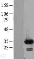 CALB2 / Calretinin Protein (Over-Expression Lysate Myc-DDK (Flag))