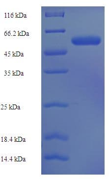 Human ST3GAL3 / ST3N Protein (Recombinant His-SUMO)