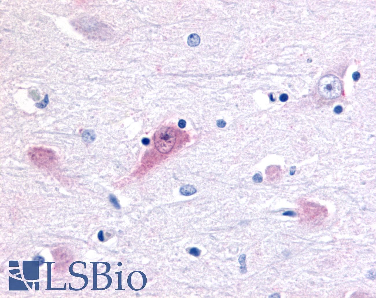 PathPlus™ Polyclonal Rabbit anti-Human RORB / ROR Beta Antibody (Ligand-binding Domain, IHC)