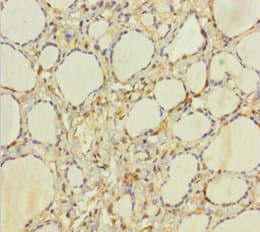 HEBP2 Antibody (aa2-205)