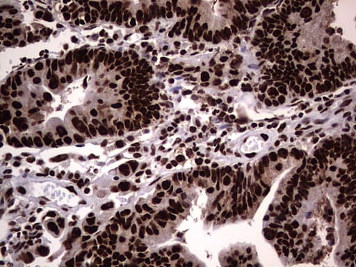 Monoclonal Mouse anti-Human HNRNPL / hnRNP L Antibody (clone OTI9G7, aa270-502, IHC, WB)