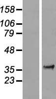 FAM84A Protein (Over-Expression Lysate Myc-DDK (Flag))