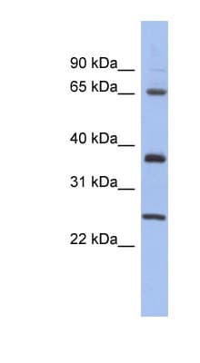 Polyclonal Rabbit anti-Human HORMAD2 Antibody (aa107-156, WB)