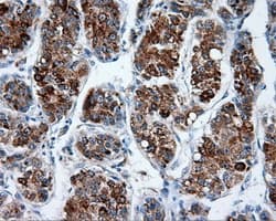 HMRF1L / MTRF1L Antibody (clone OTI1C5)