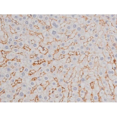 Polyclonal Rabbit anti-Human MAPT / Tau Antibody (phospho-Thr181, IHC, WB)