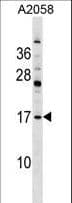 PDE6D / PDE6 Delta Antibody (aa26-55)