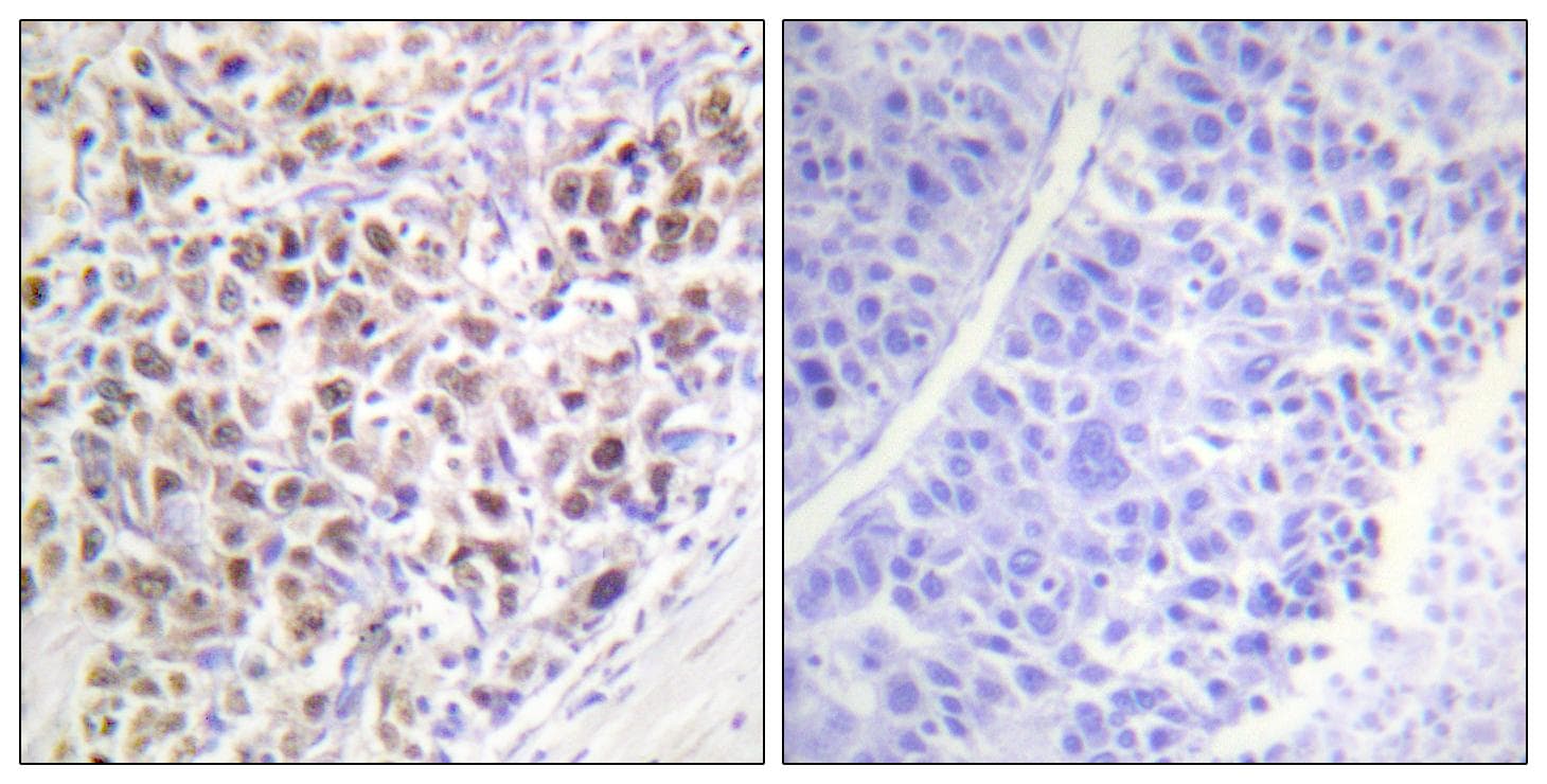 Polyclonal Rabbit anti-Human AURKB / Aurora-B Antibody (phospho-Thr232, IHC, IF, WB)
