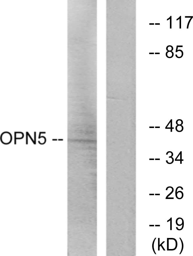 OPN5 / Neuropsin Antibody (aa251-300)
