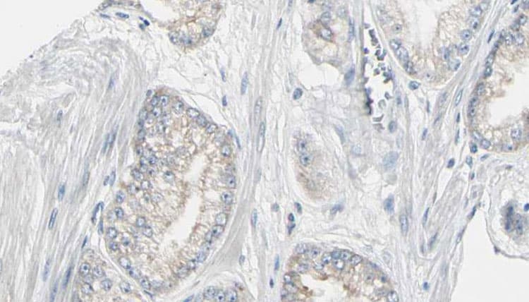 PYGL Antibody