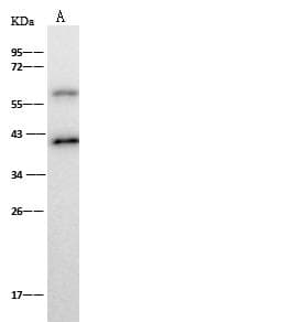 RABEPK / p40 Antibody (Preservative Free)