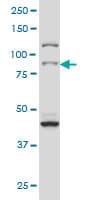 IHC-plus™ RPS6KA2 / RSK3 Antibody (clone 1F6)
