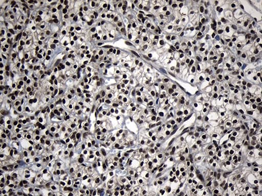 ZNF583 Antibody (clone OTI4D2)