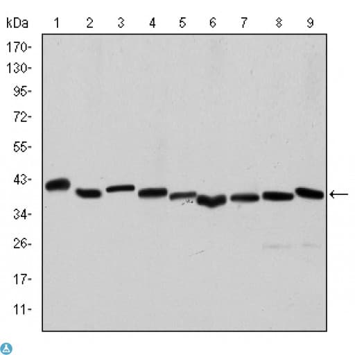 ACTA2 / Smooth Muscle Actin Antibody