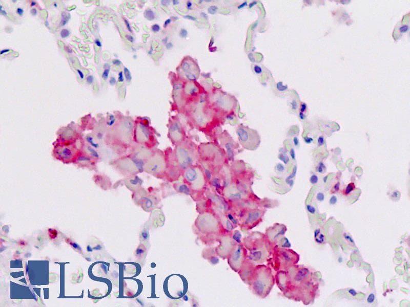 PathPlus™ SPN / CD43 Antibody