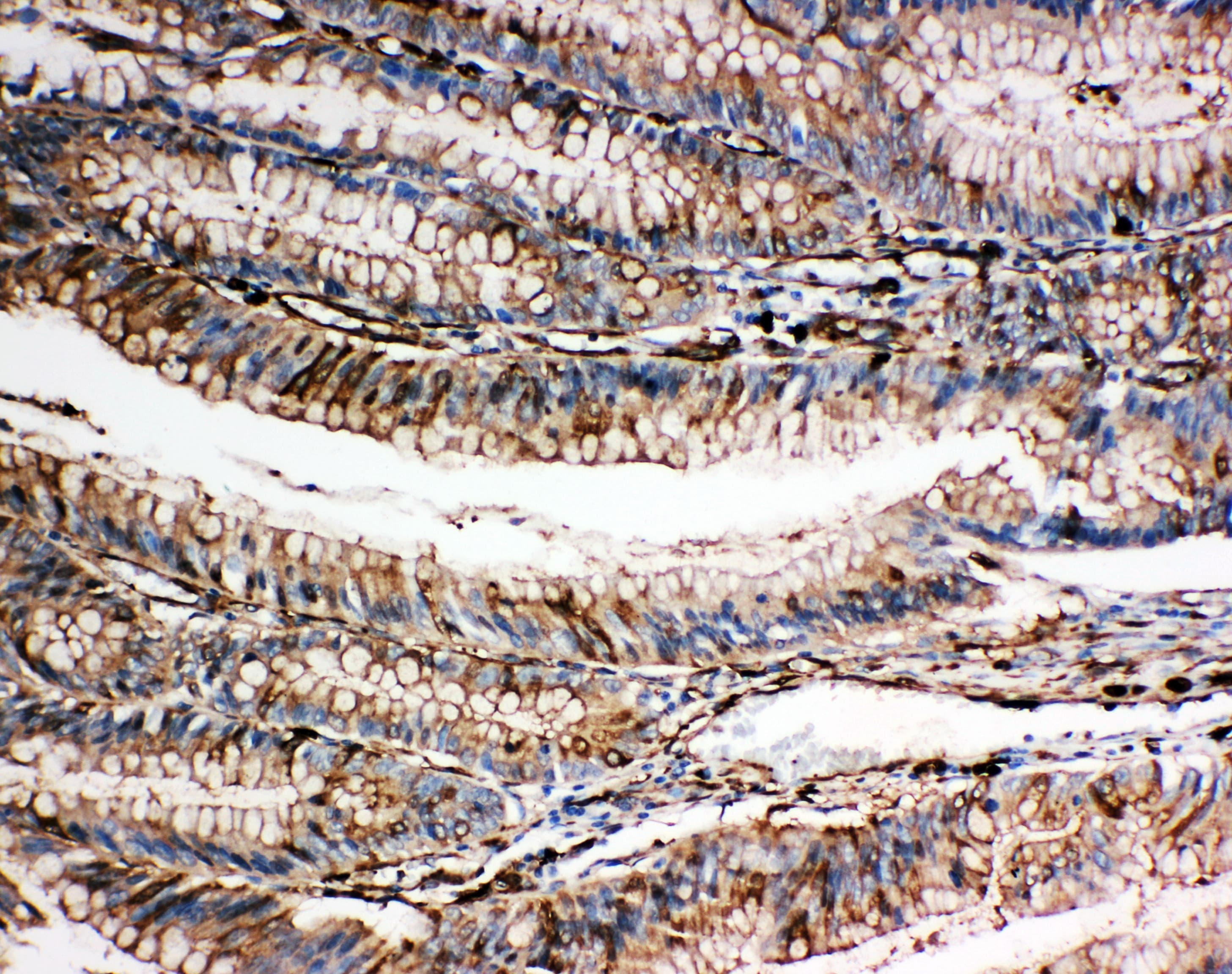 GSN / Gelsolin Antibody (aa763-775)
