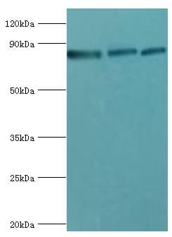Polyclonal Rabbit anti-Human EZH1 / ENX-2 Antibody (aa160-280, IHC, WB)