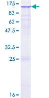 Human RASA1 Protein (Recombinant GST)
