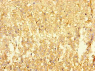 RTN4IP1 / NIMP Antibody