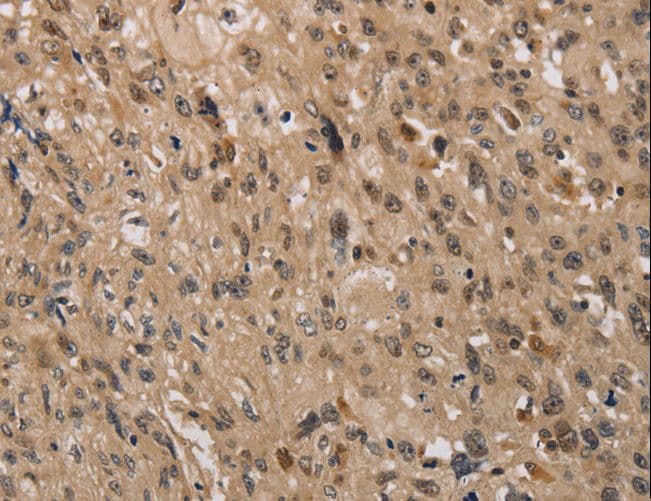 KDM4A / JHDM3A / JMJD2A Antibody