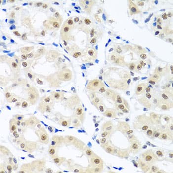 p84 / THOC1 Antibody